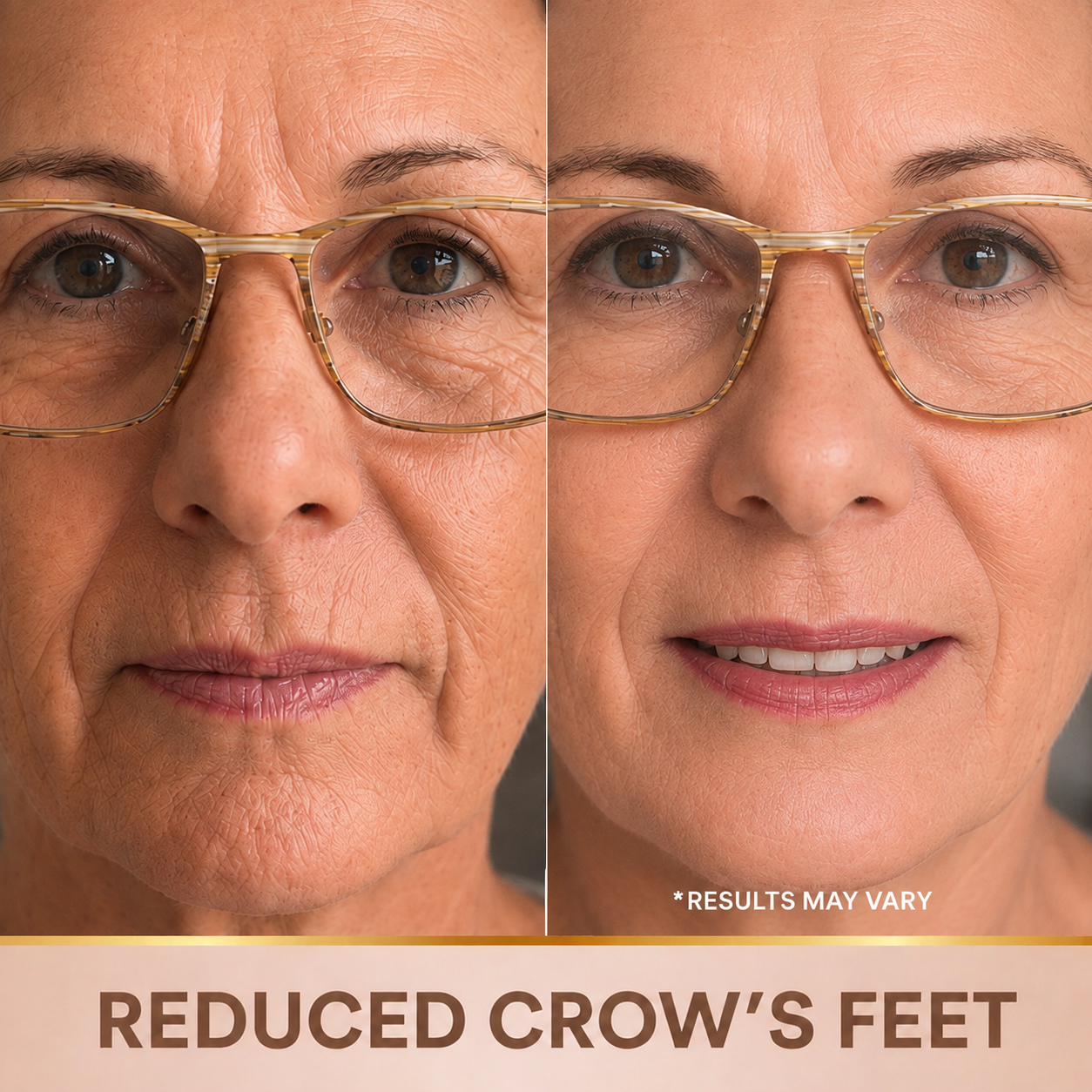 BioVella™ – Korean Lifting-Effect Serum (Visible from the First Application)